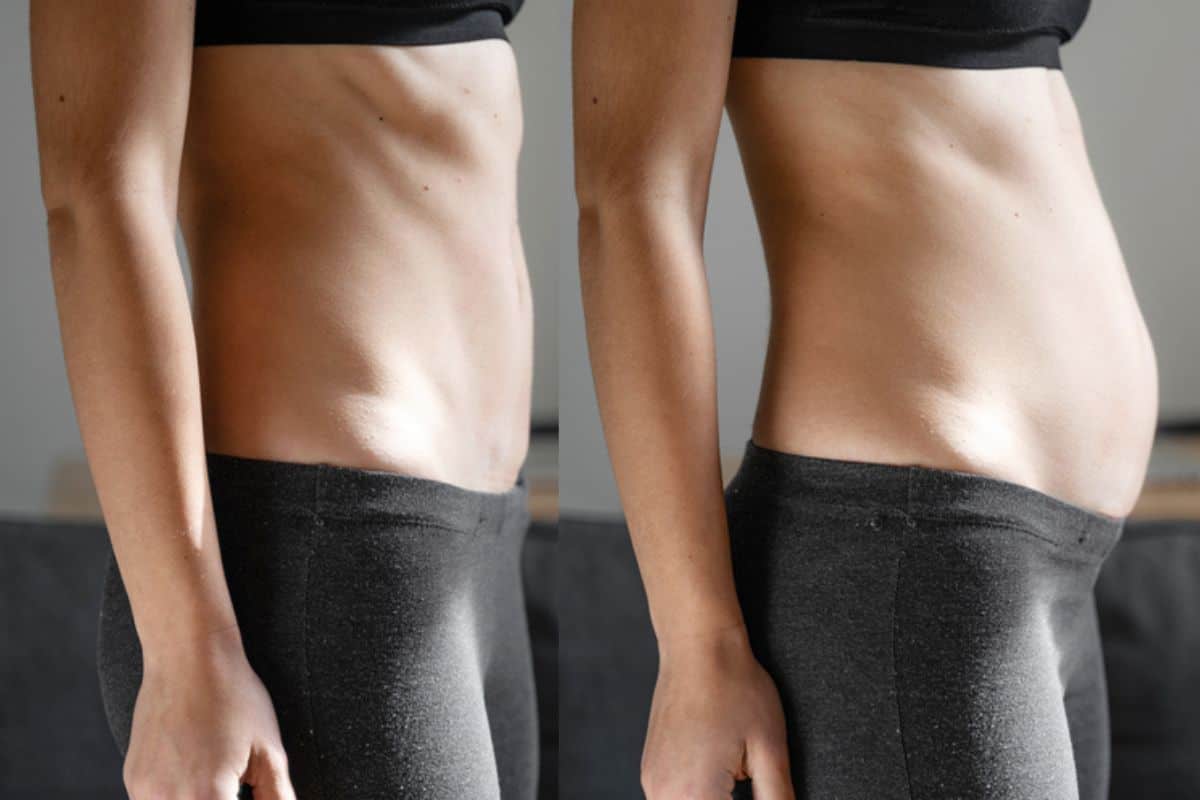 How long does diastasis recti take to improve Blackwall?