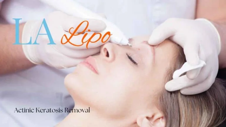 Woman receiving Actinic Keratosis Removal Treatment Blackwall