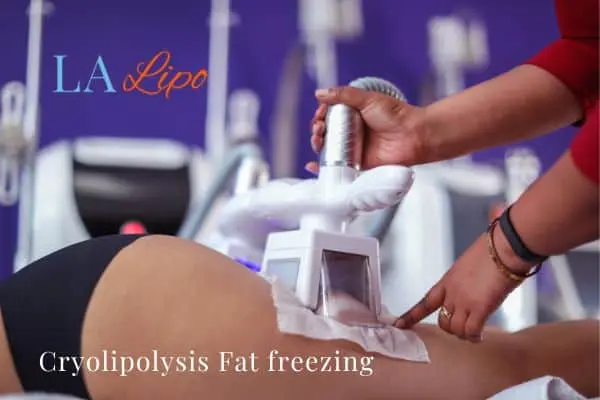 women getting fat freezing Blackwall