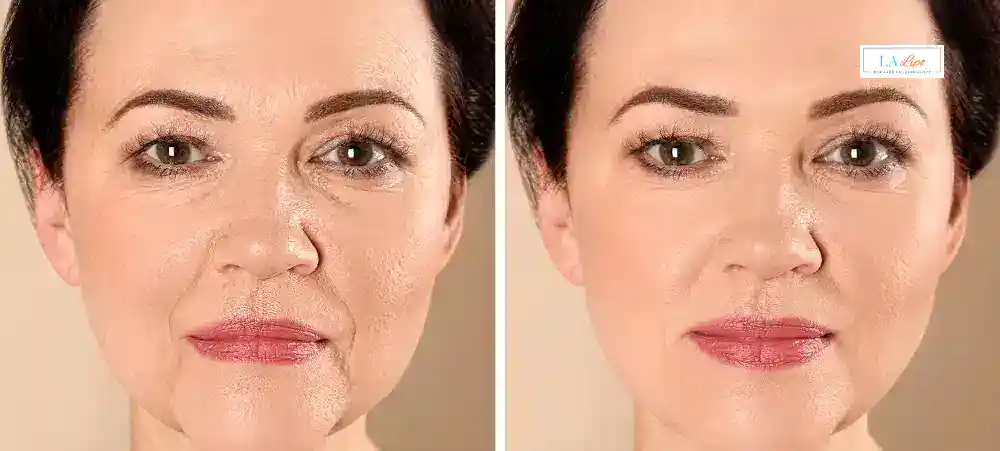 Why Aren’t My Skincare Products Making My Sagging Skin Look Firmer Blackwall?