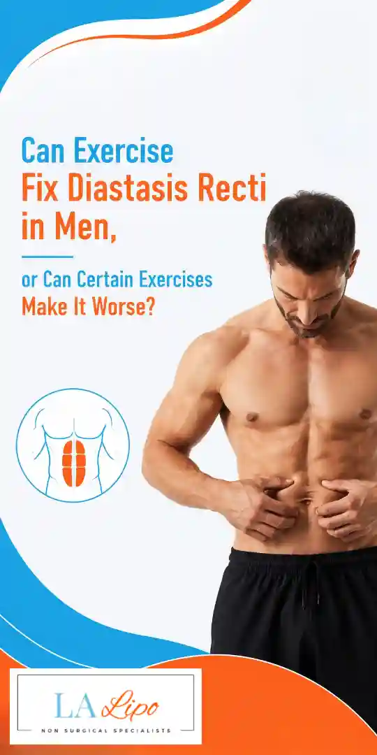 Can Exercise Fix Diastasis Recti in Men, or Can Certain Exercises Make It Worse Blackwall?